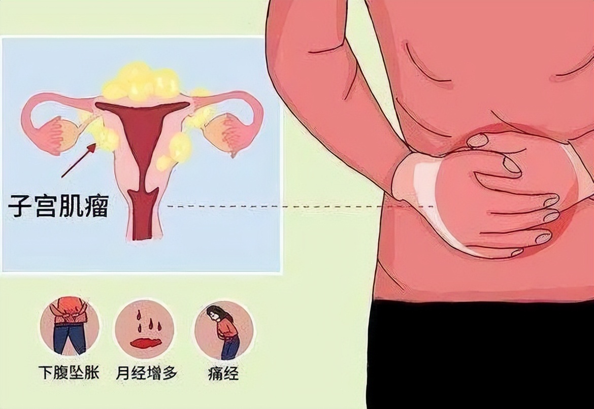 经常长子宫肌瘤是什么原因,女性患有子宫肌瘤应禁忌哪些食物