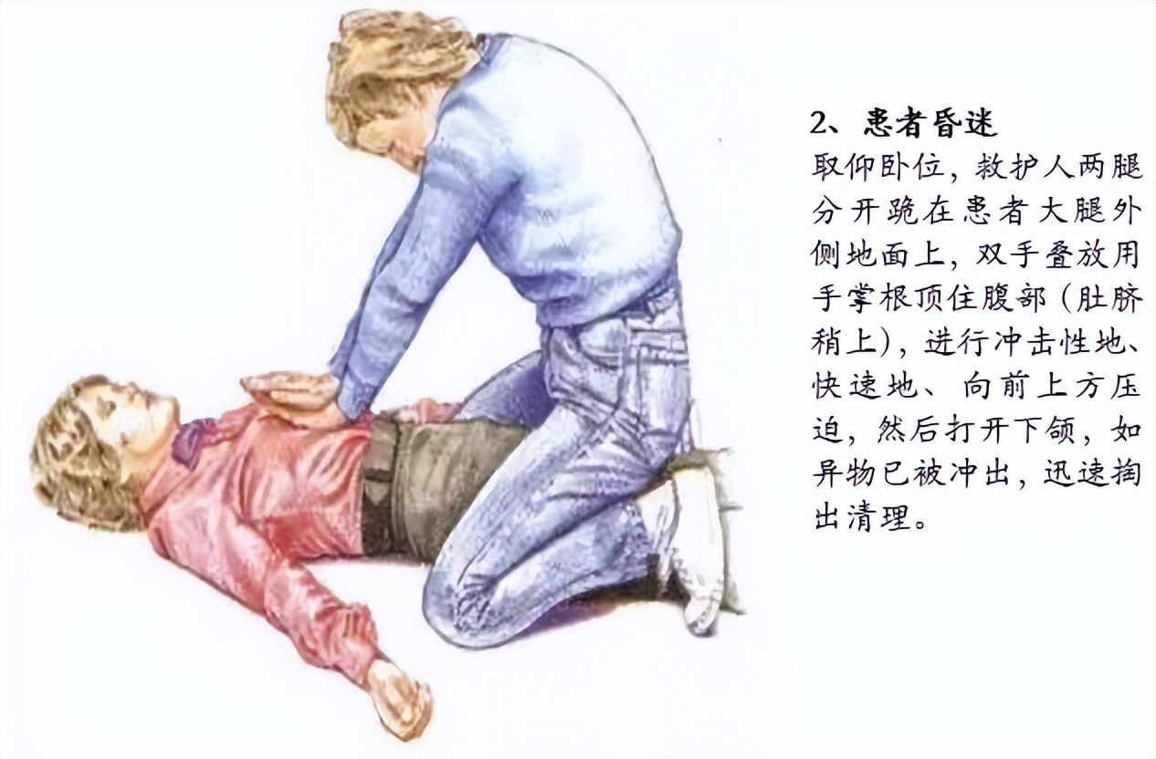 不小心异物卡喉了怎么办,不小心被卡住怎么自救