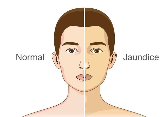 肝功能正常还吃养肝护肝药吗,肝功能下降会出现这5个信号