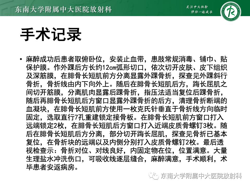 左腓骨下段骨折伴下胫腓联合分离,好文分享深度揭秘