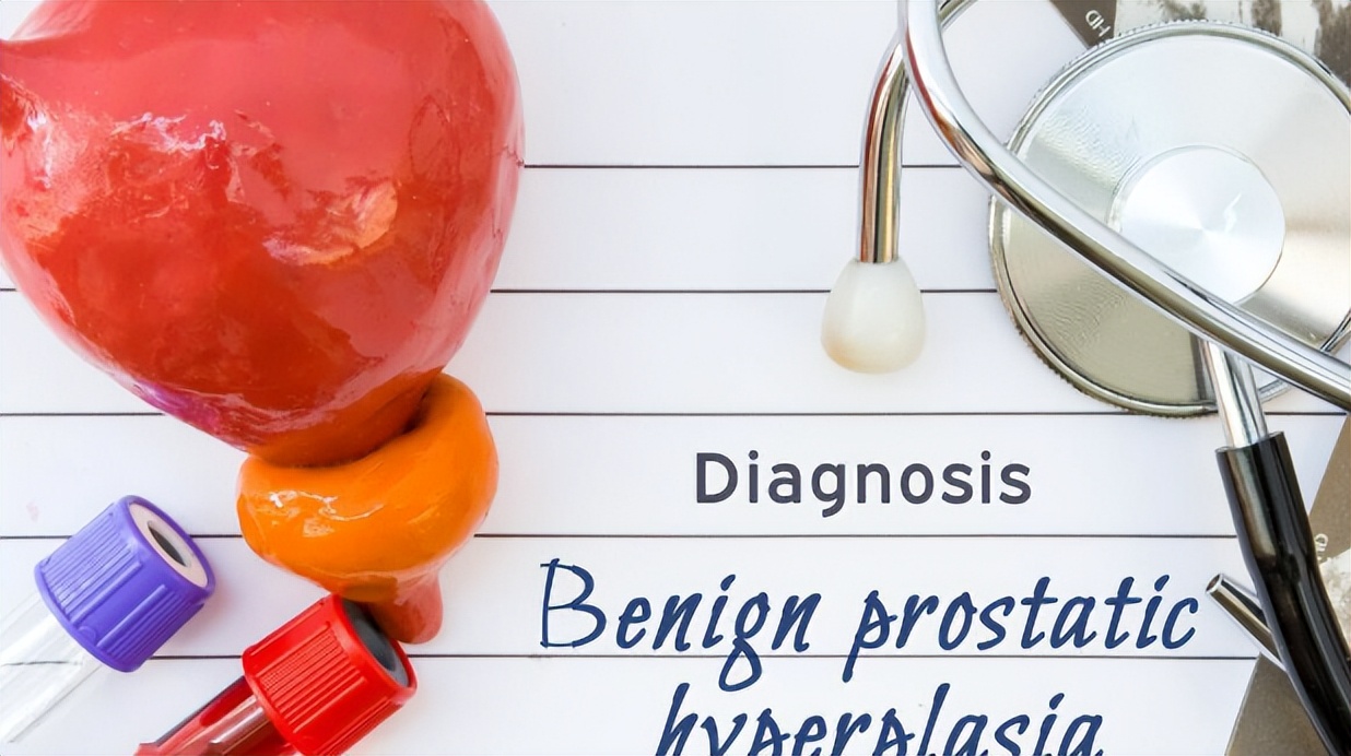 华山论鉴治前列腺增生四大药物,治疗良性前列腺增生的4大王牌