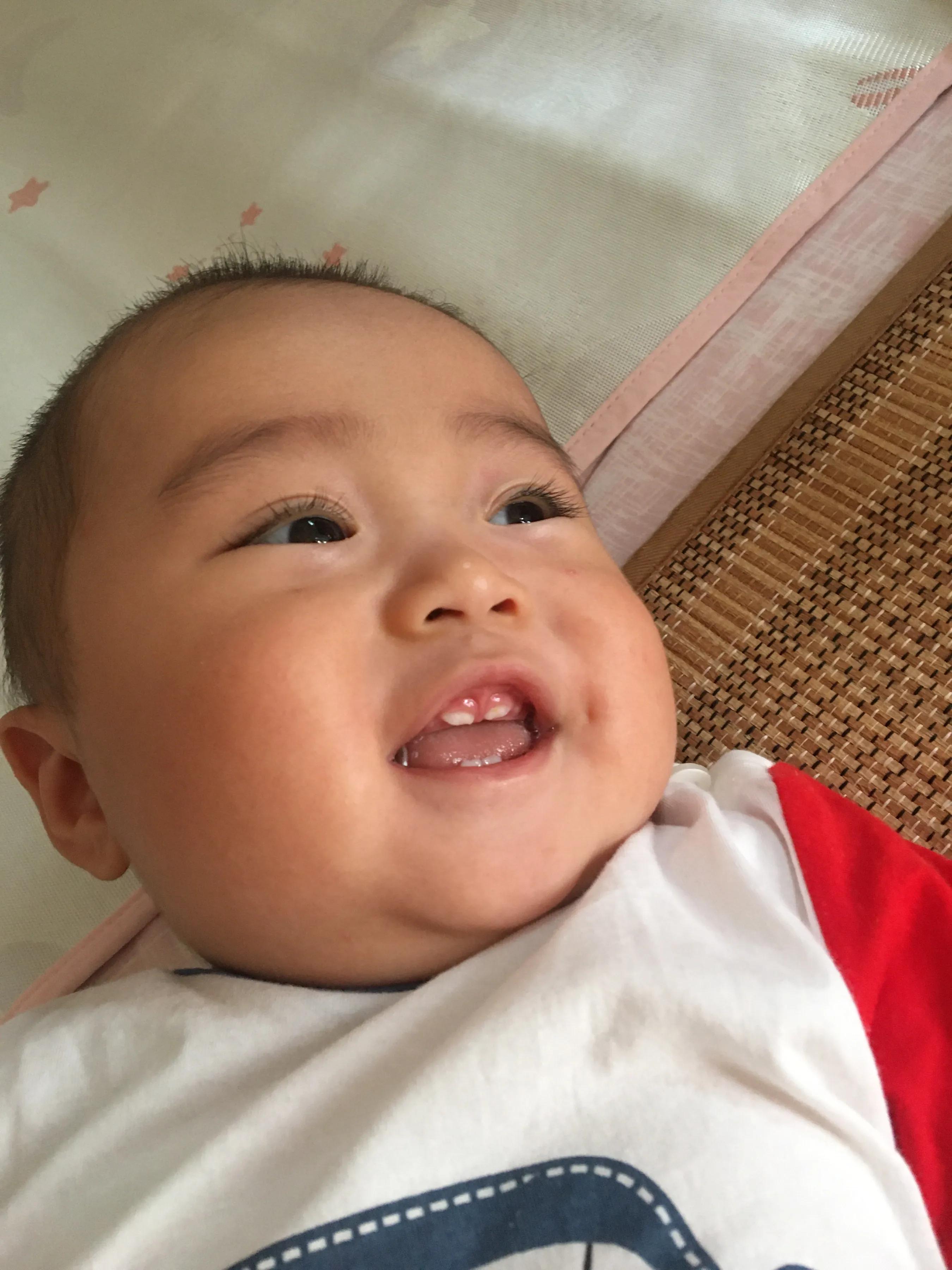 宝宝湿疹母亲有什么忌口的吗,婴儿湿疹大作战之护理的6大要点