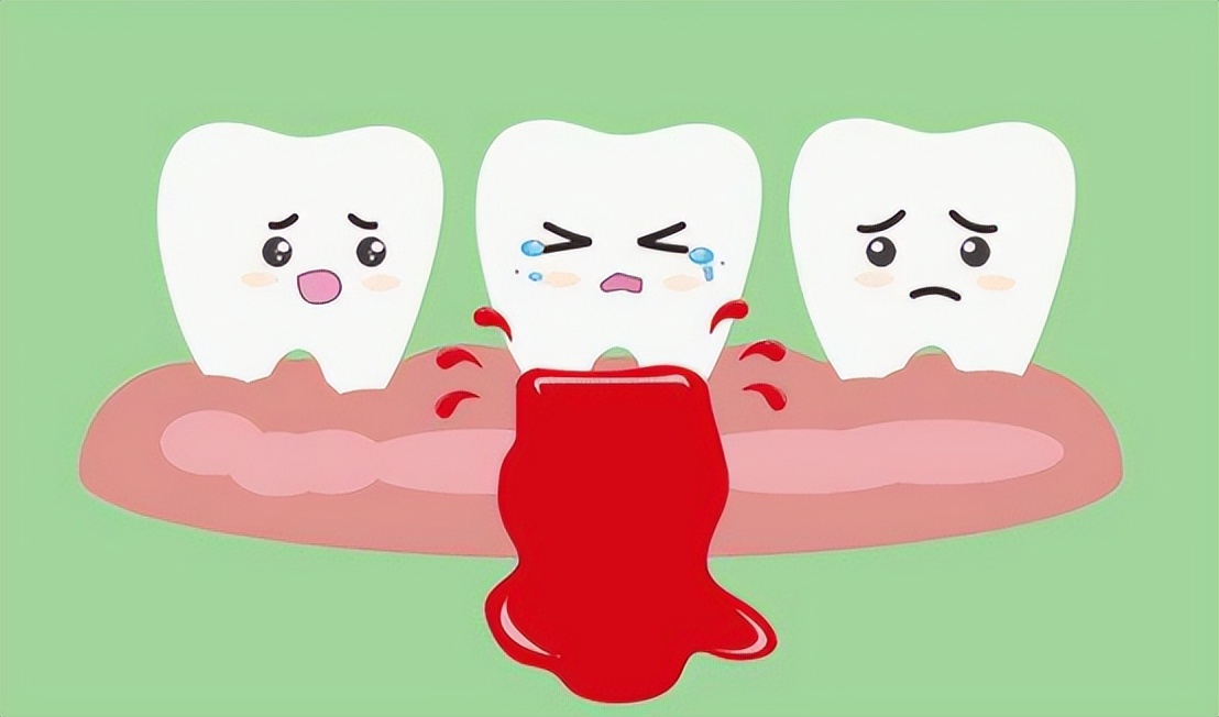 电动牙刷哪个品牌好科普,哪个品牌的电动牙刷质量最好