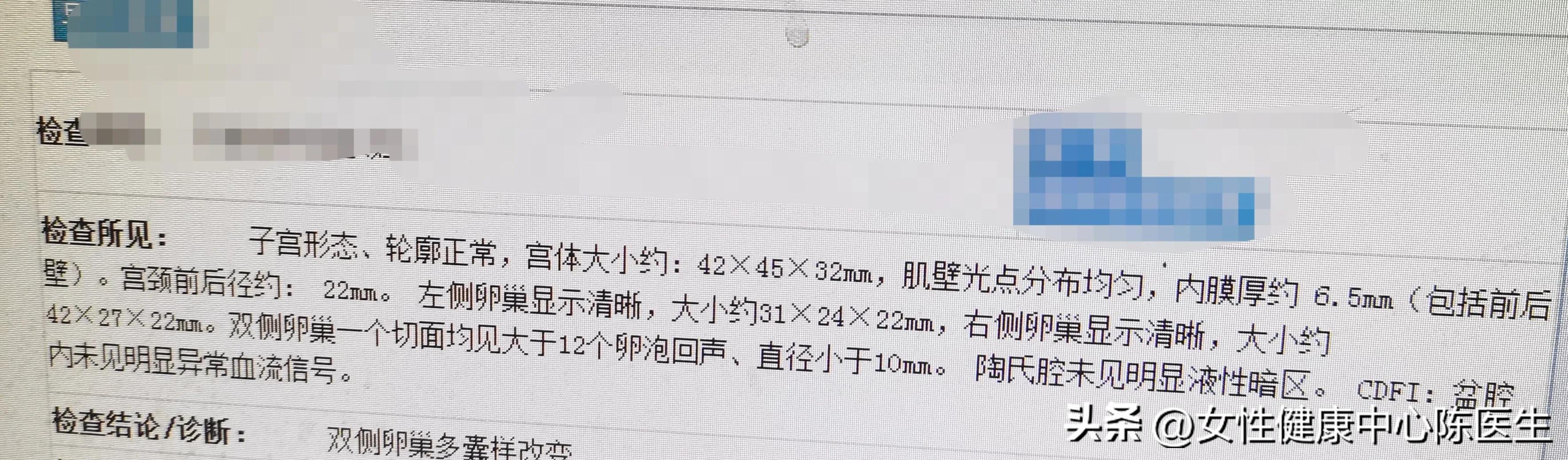 桃红四物汤治多囊卵巢,黄煌温经汤治疗多囊卵巢综合征