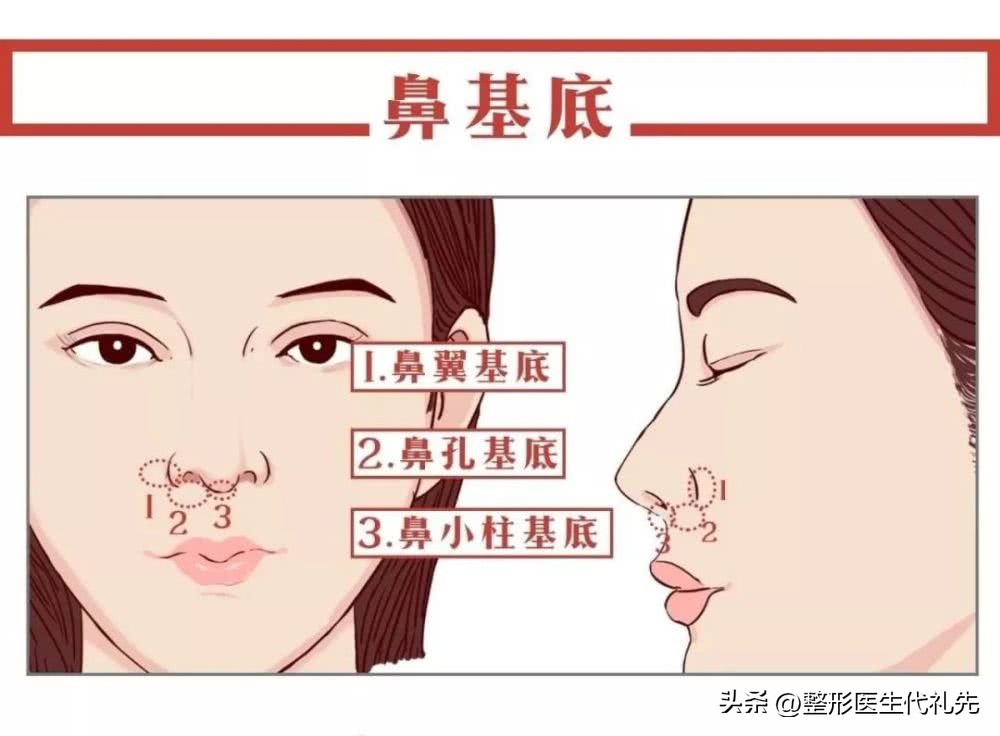 面部法令纹怎么去除,去除法令纹的日常方法