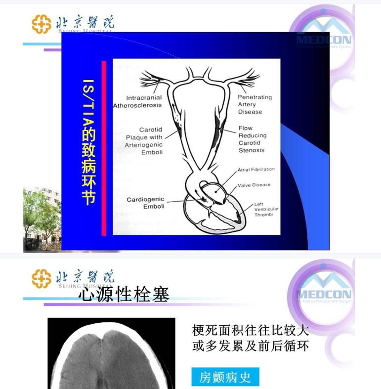 速来|想解开卒中的奥秘，得有这23份不得不知道的宝典