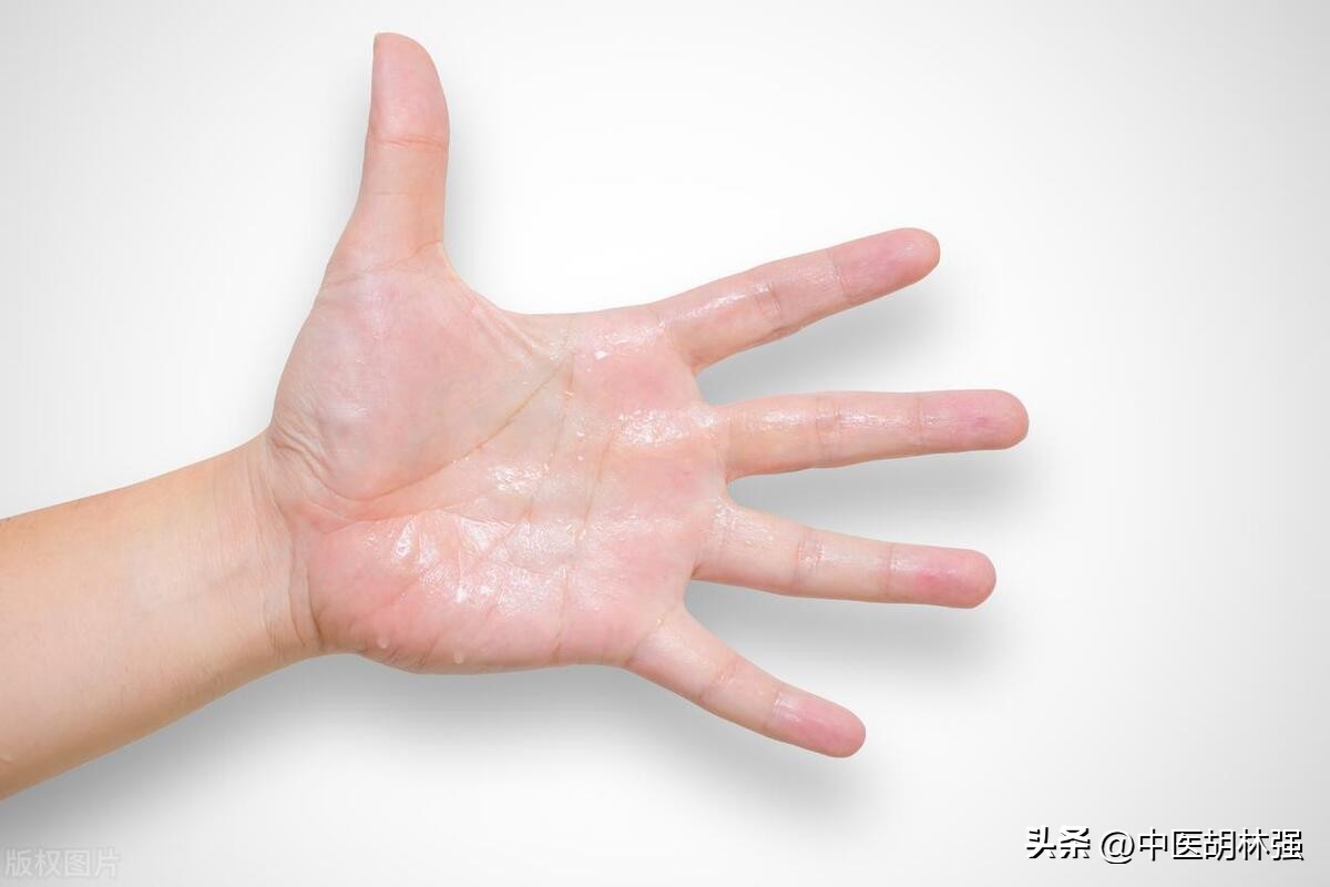 手心出汗是阴虚还是湿热虚汗,出手汗脚汗是肾阴虚还是脾胃虚
