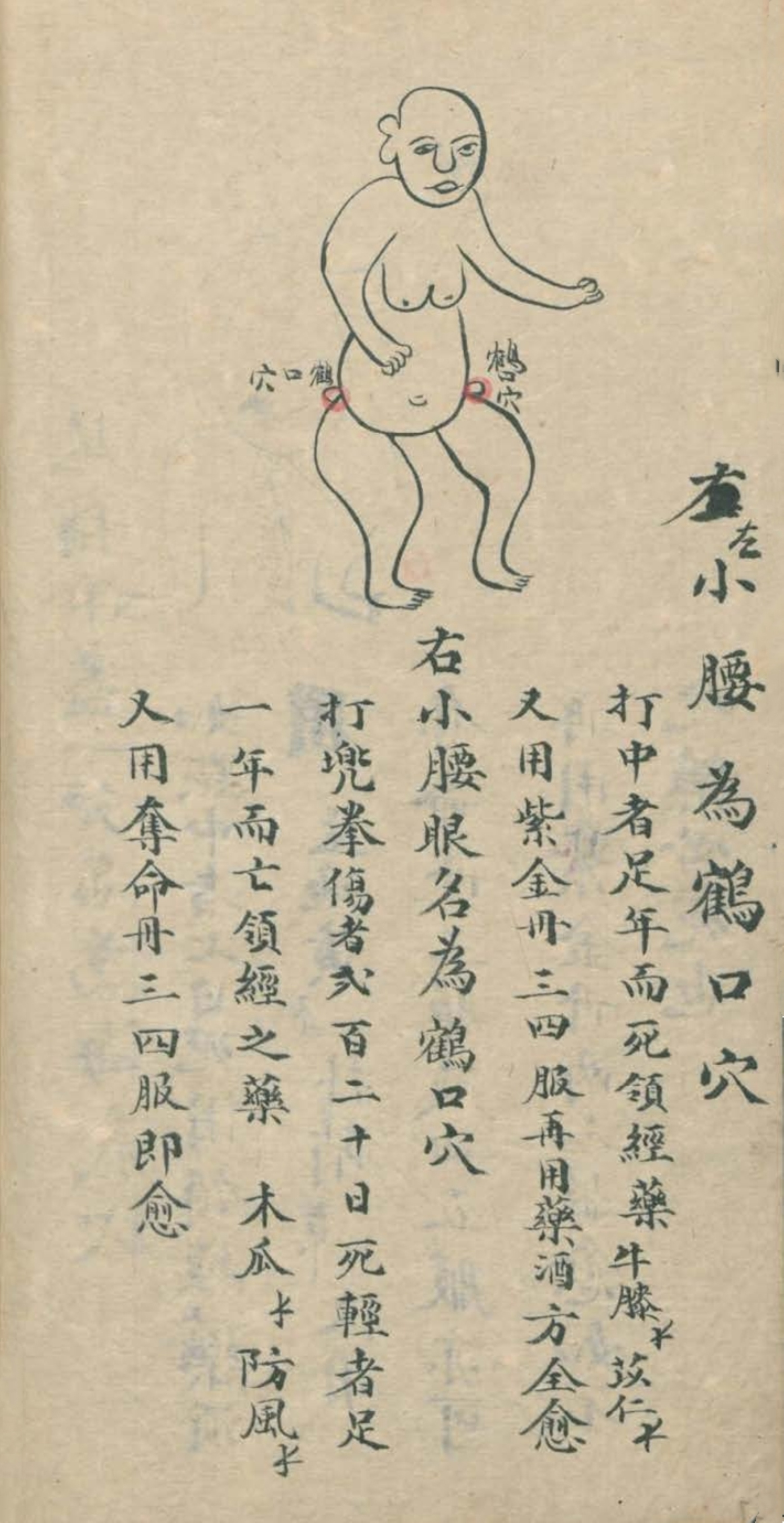 最实用的跌打药方,祖传跌打秘方100首