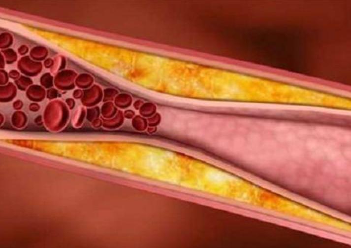 比疫情更可怕的危机来了，很多人却浑然不知，建议老百姓做好预防