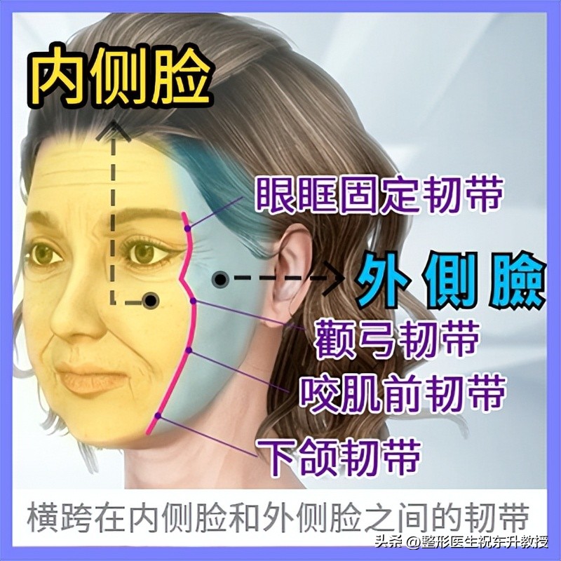 拉皮改善法令纹手术的危害有哪些,脸部法令纹做手术怎么去除