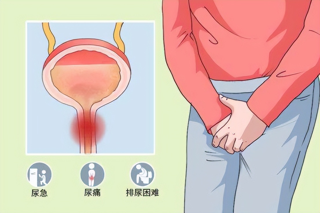 通过性传播的疾病都有哪些,五种通过性传播的疾病及其病原体