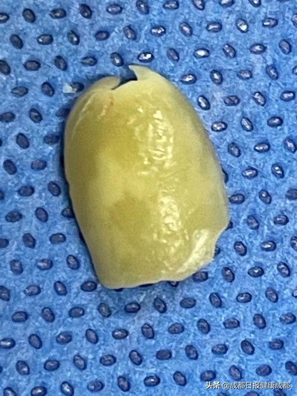 一岁半宝宝在家抢救无效,一岁半婴儿抢救无效