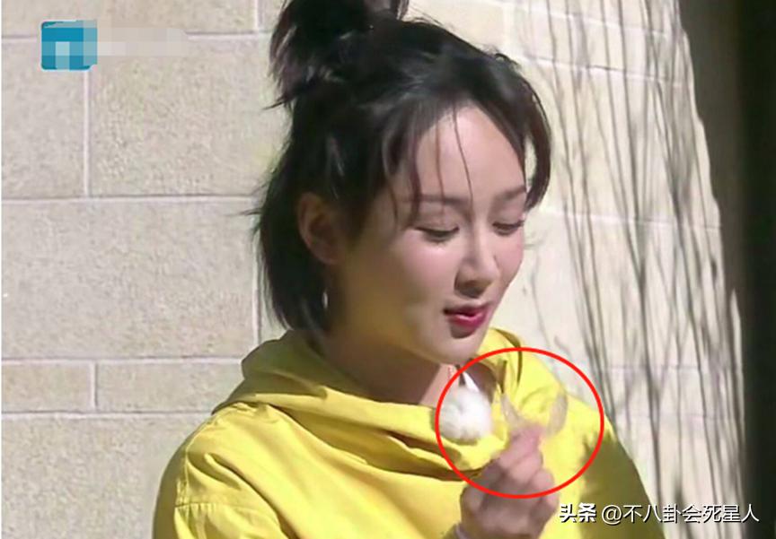 戴牙套是双刃剑：毛不易拯救一口烂牙，刘雯、肖战却变难看了