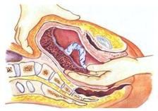 孕妈妈怎么判断胎位是正的,胎儿屁股在右侧是什么胎位
