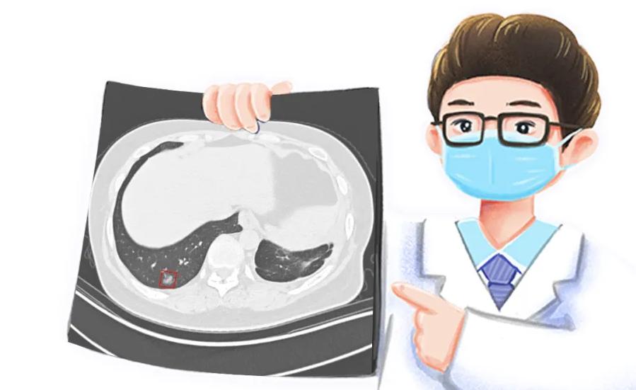 肺结节多大需警惕癌症,发现肺结节怎么知道是结节还是癌