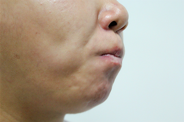 槟榔行业的乱象,槟榔行业最近出什么问题了