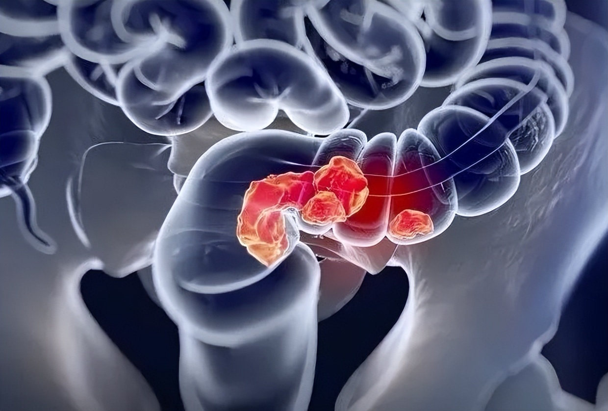 马大军中医治肿瘤怎么样,中医马大军医生怎么样