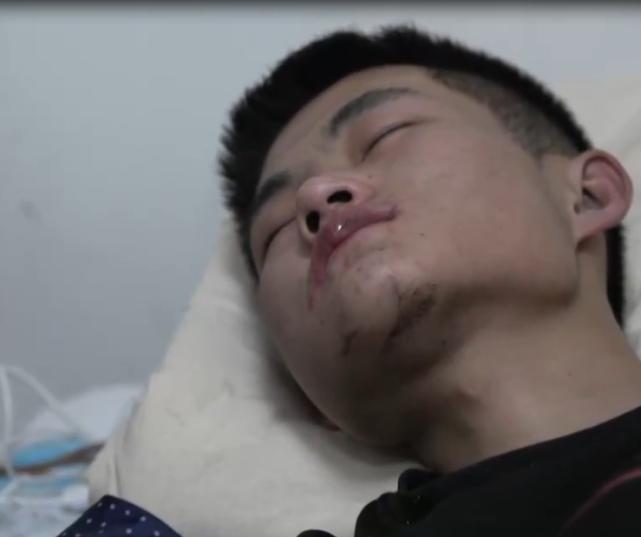 小伙喝下百草枯被医生抢救回来,29岁小伙喝下百草枯农药拒绝治疗