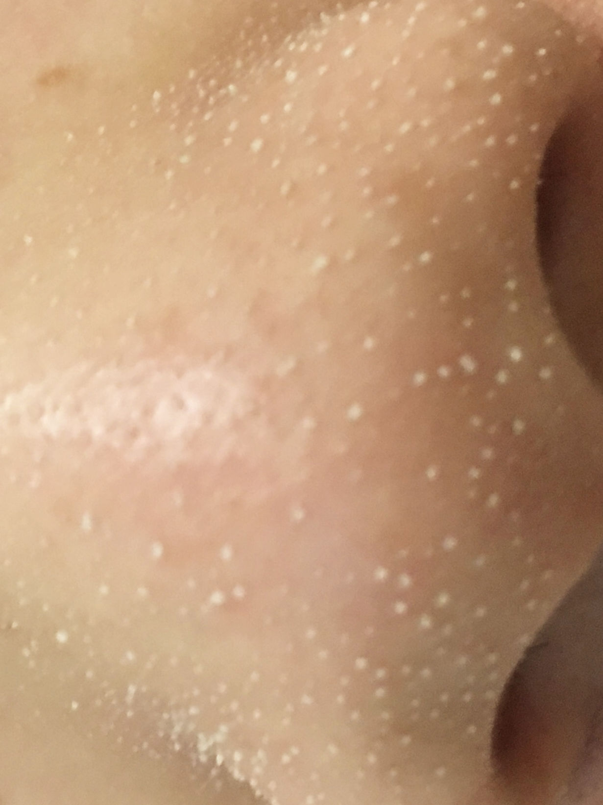 美容院护肤去黑头正常价格,小气泡去黑头美容仪器