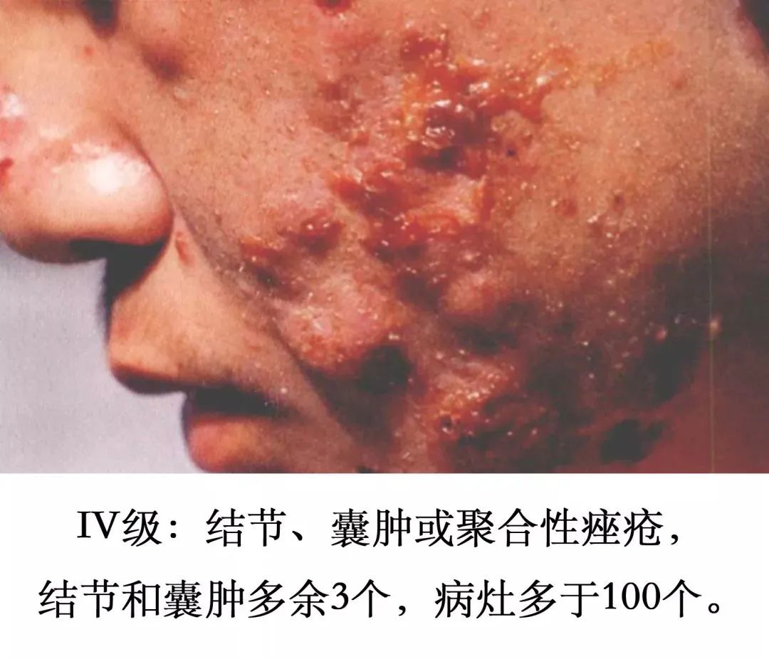 养成干净脸的最好方法,养成干净脸