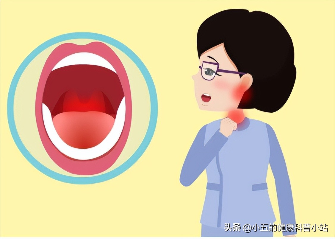 卡马西平癫痫用法用量,卡马西平治疗癫痫病目前最好的药