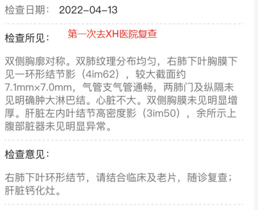 磨玻璃结节9*8mm建议随访,8mm磨玻璃结节一年没长