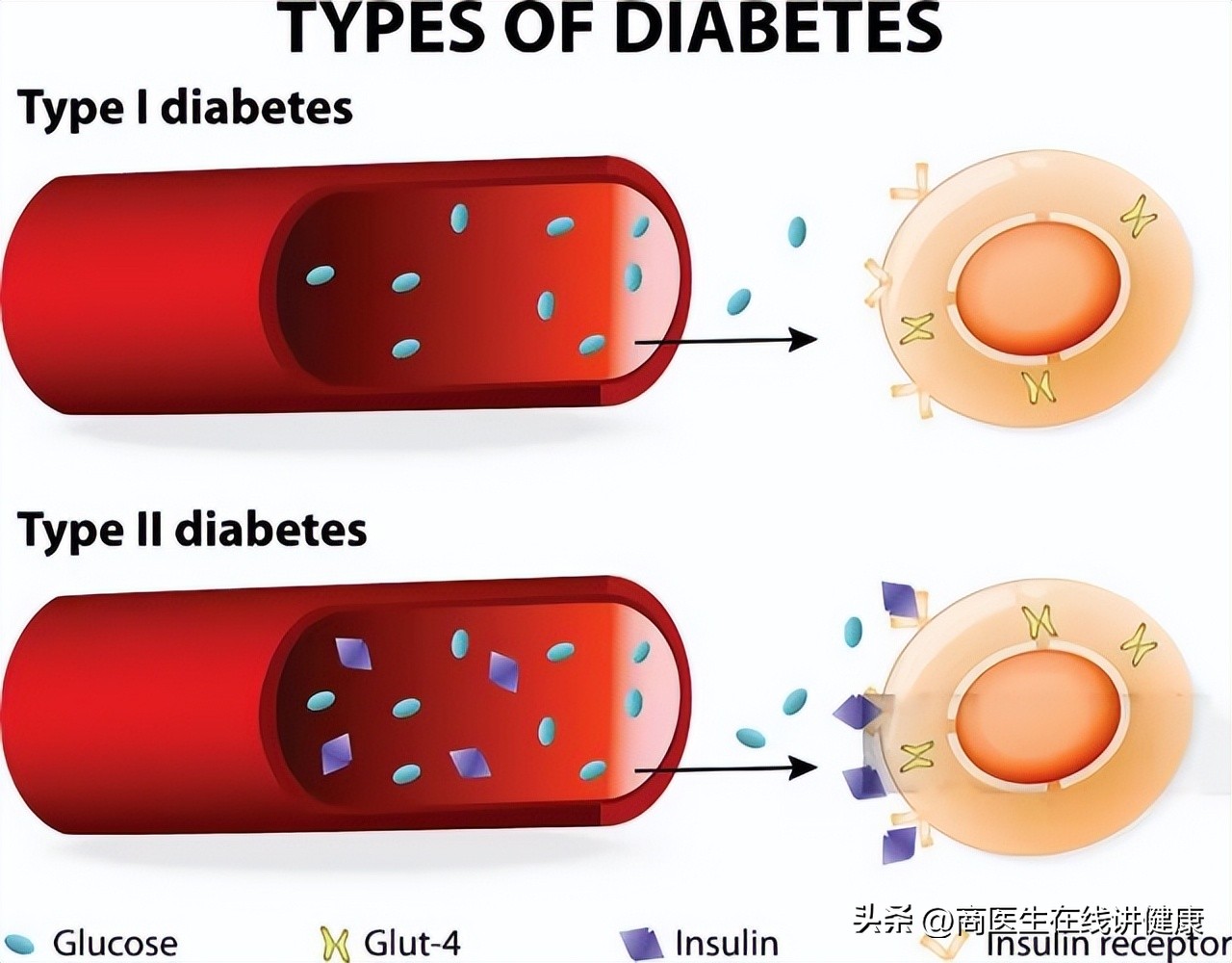 降糖药达格列净长期吃有什么害处,揭密降糖神药达格列净健康科普