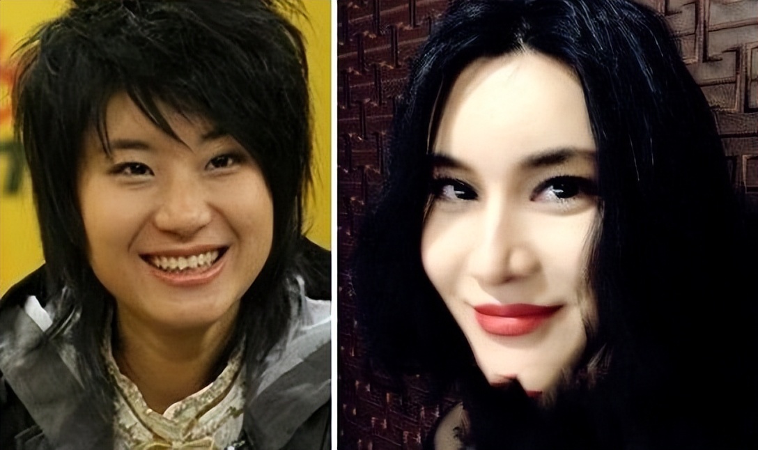 假下巴对决！谁的能戳死人，谁的下一秒就飞出去，谁的越整越残？