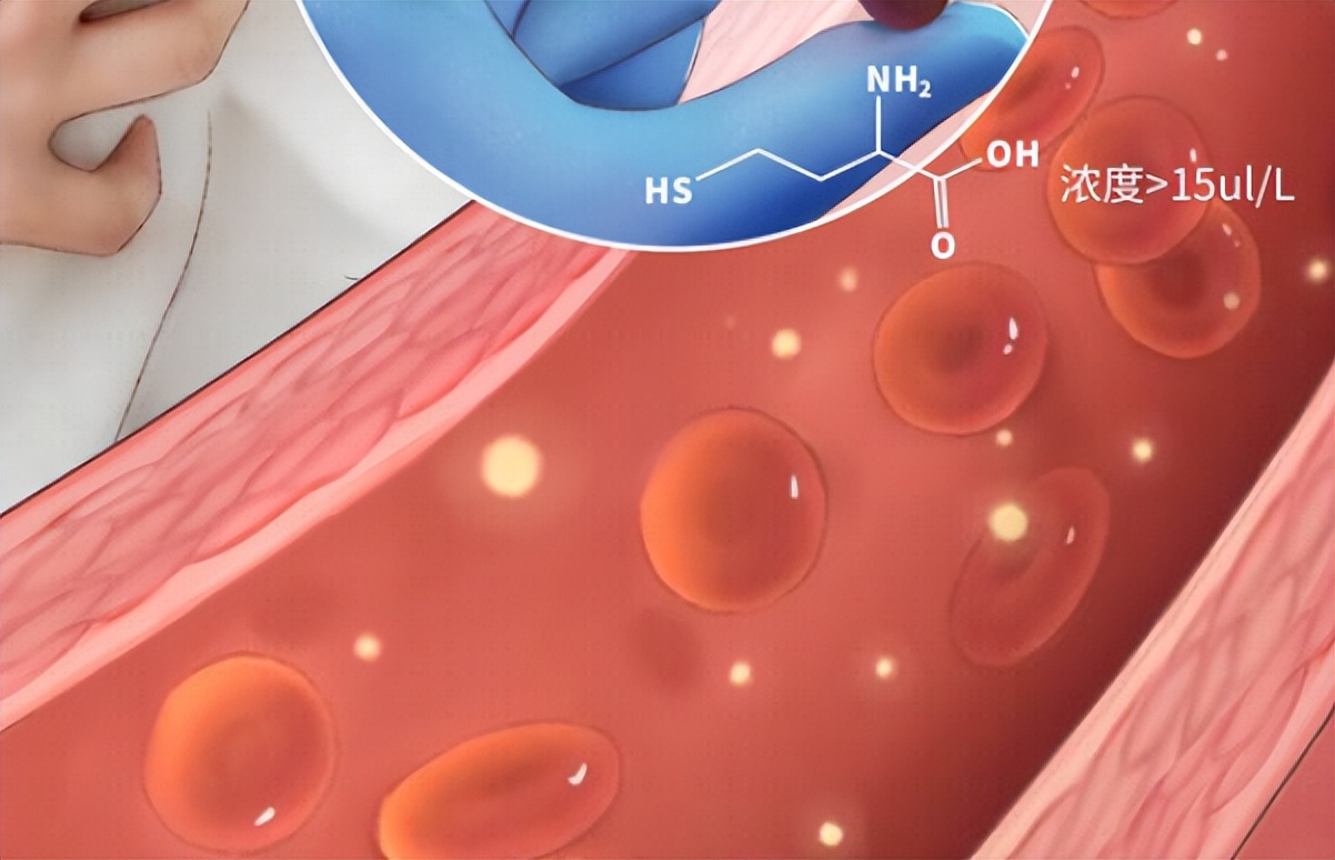 同型半胱氨酸会引起高血压咋治疗 (高血压患者伴随高同型半胱氨酸)
