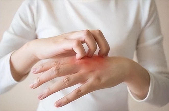 得了湿疹如何快速治疗,得了湿疹最佳治疗方法