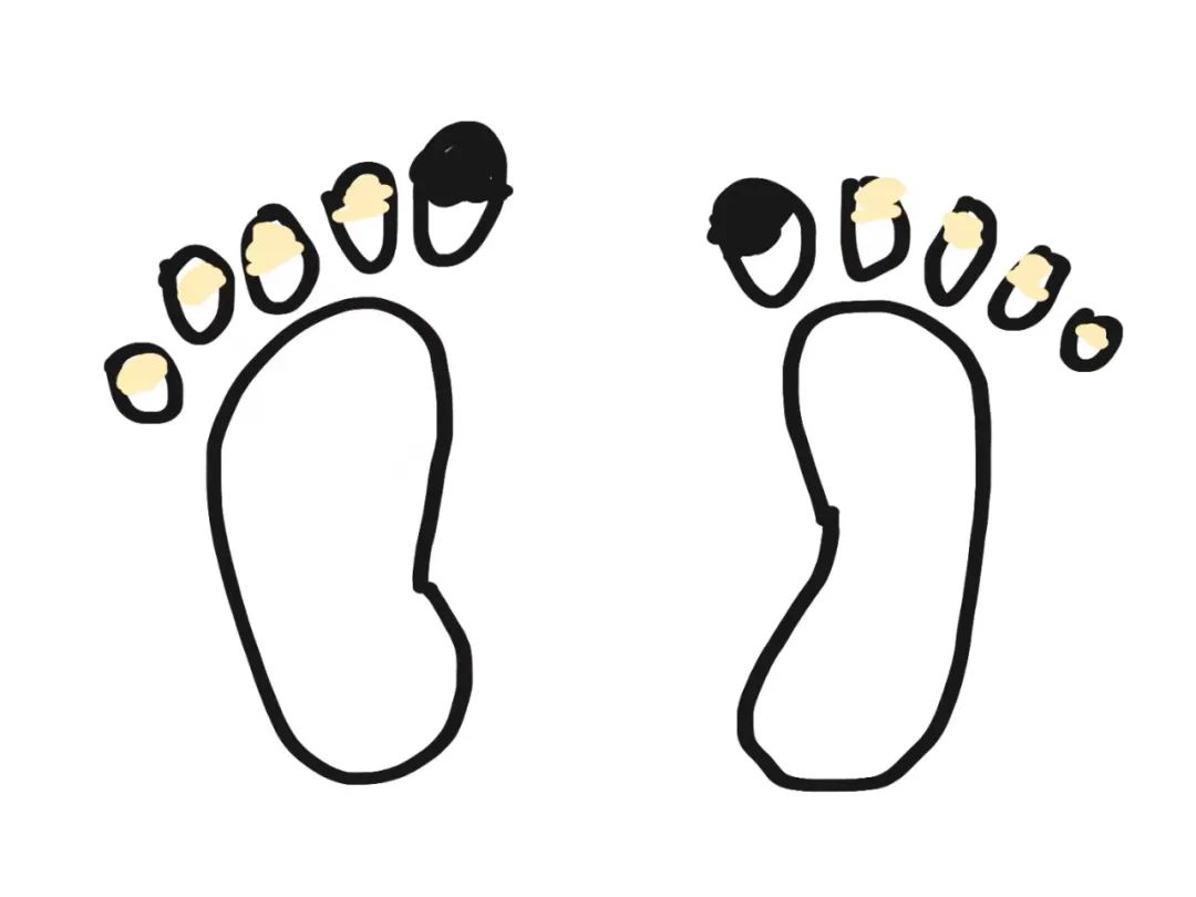 领队团解惑：下山时大拇脚指被鞋子顶黑了，该怎么办呢？