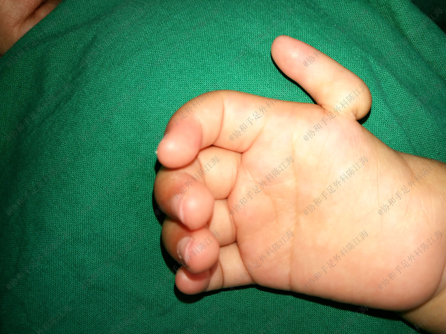 宝宝5个月右手一直动,宝宝5个月了大拇指还在手里面