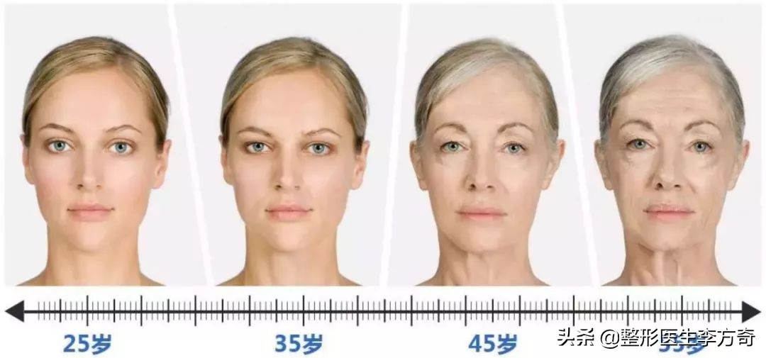 打除皱针与抗衰针有啥区别,除皱针一般哪种姿势会更好操作