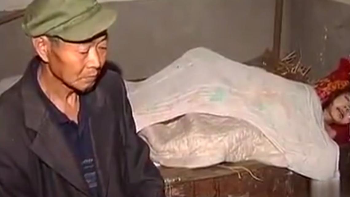 四川10岁女孩生命垂危,四川十岁女孩身体溃烂父母辟谣