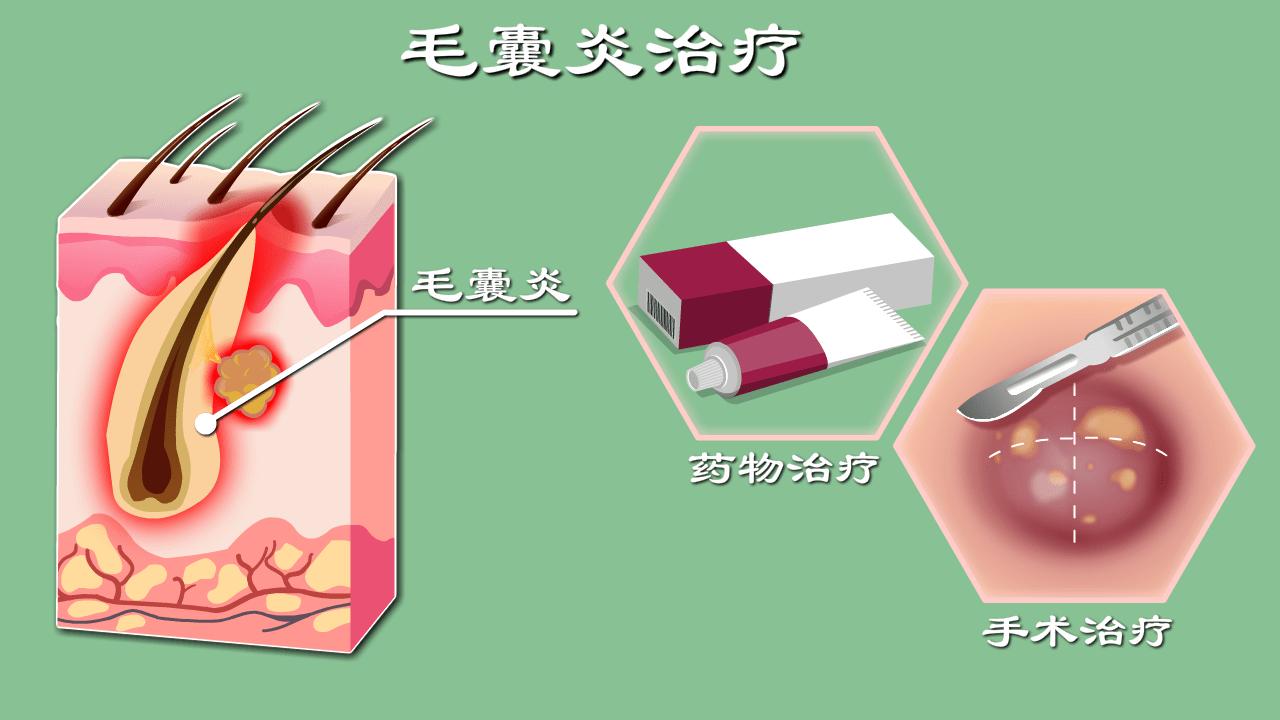 女人下身长痘痘是什么病怎么治,女性下部长了痘是什么原因