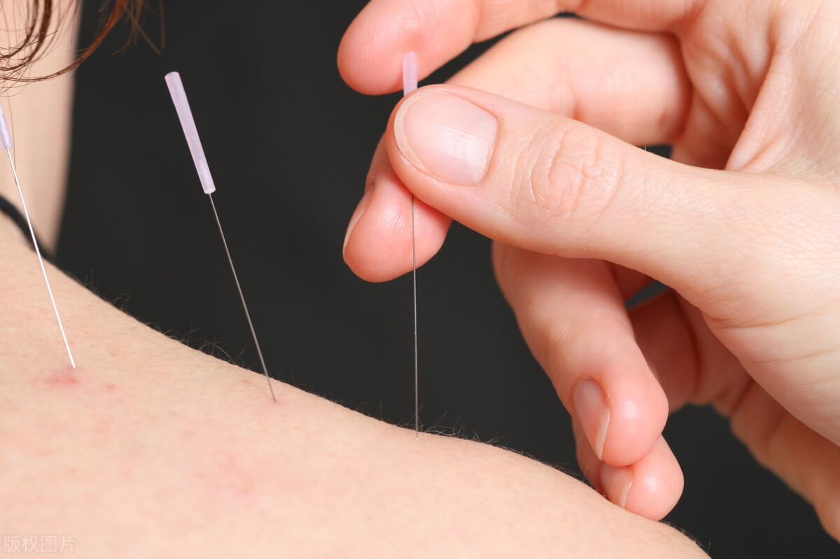 新冠肺炎针灸哪个穴位,李漾左氏针灸