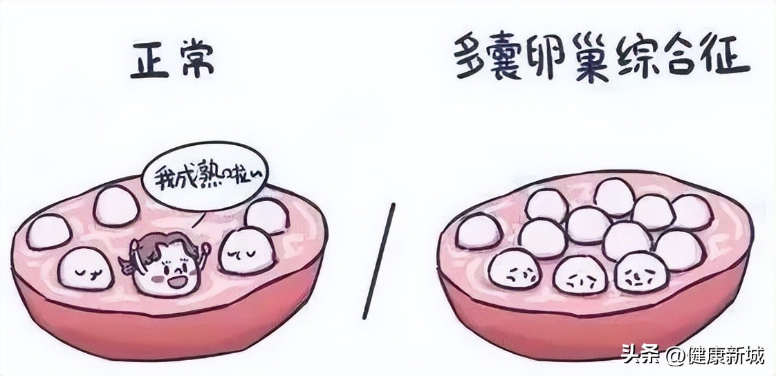 健康科普妇科病,医学知识科普女性多囊