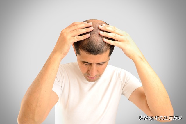 年轻人还在为秃头掉发而烦恼吗,18岁秃头越来越严重是什么原因