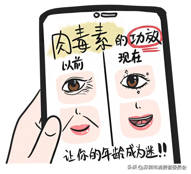 肉毒素打多少不算超标,肉毒素打多了会不会有副作用