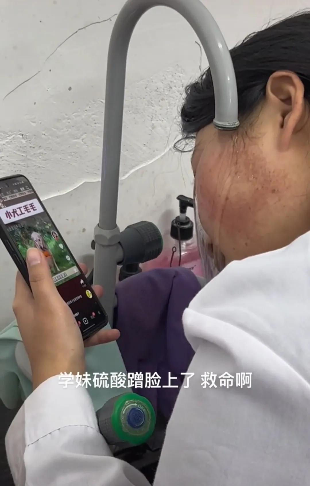 硫酸蹭到脸上,硫酸溅到脸上多久能恢复