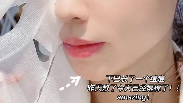 祛痘修护面膜测评红榜,好用的美白祛斑面膜测评