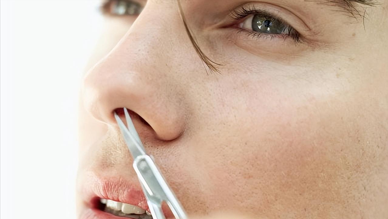 鼻毛白是变老了吗,鼻毛变白是什么原因怎么治疗