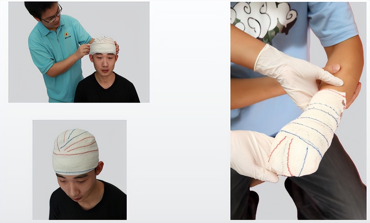 外伤出血的现场包扎技术,外伤出血如何清创包扎