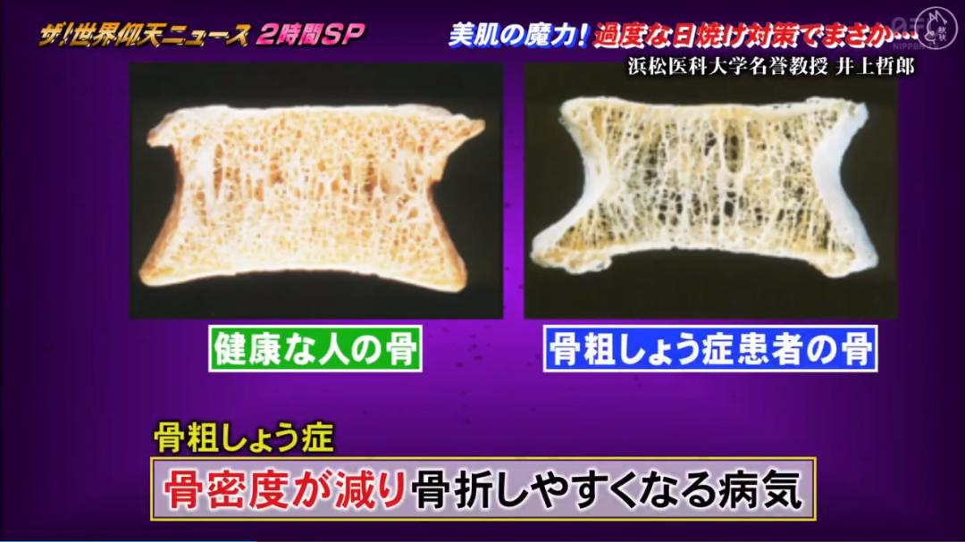 日本漂亮小姐姐不想被晒黑，每天全副武装！2年后身高竟缩水7cm…