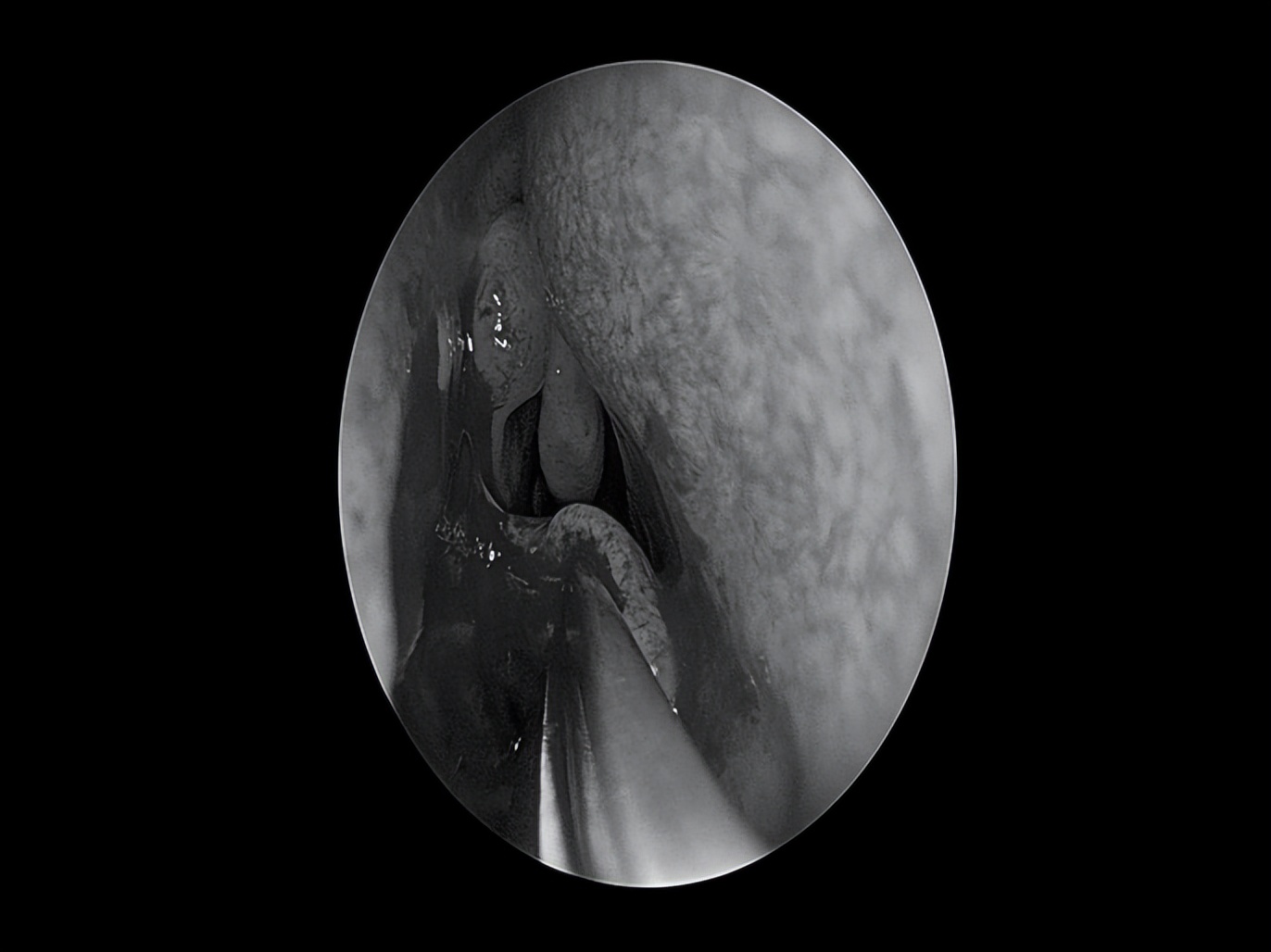 南昌二附院耳鼻喉科手术,南昌大学第二附属医院耳鼻咽喉科