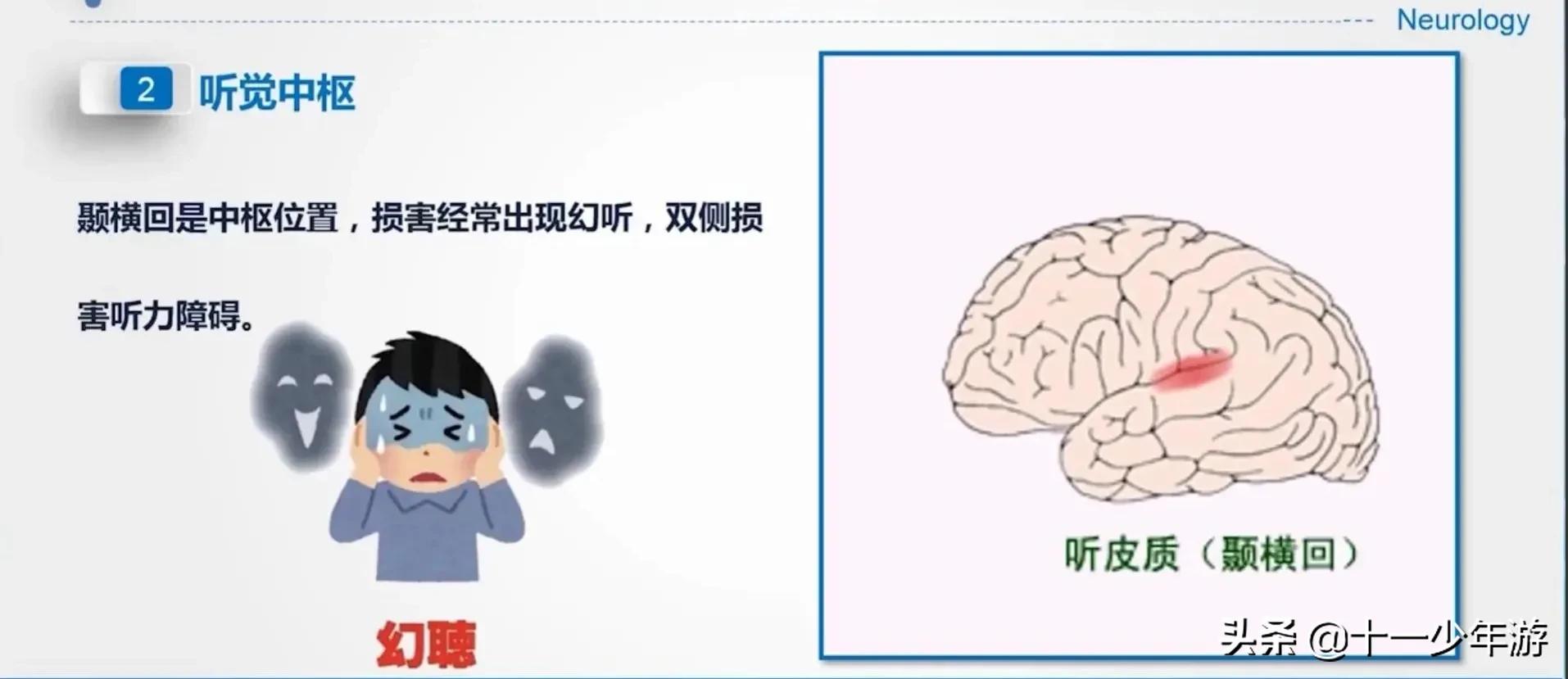 大脑的结构解剖示意图,大脑镰下疝解剖结构