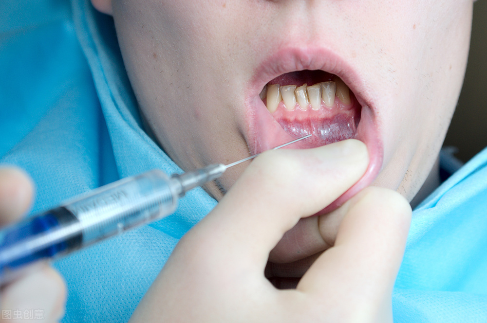 什么是麻醉过敏,什么是麻醉