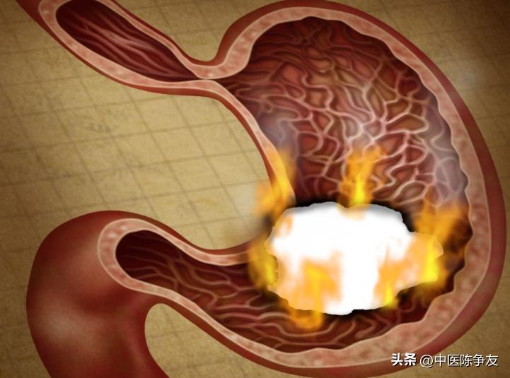 去肝火去胃火的一味中药视频,降胃火两味中药