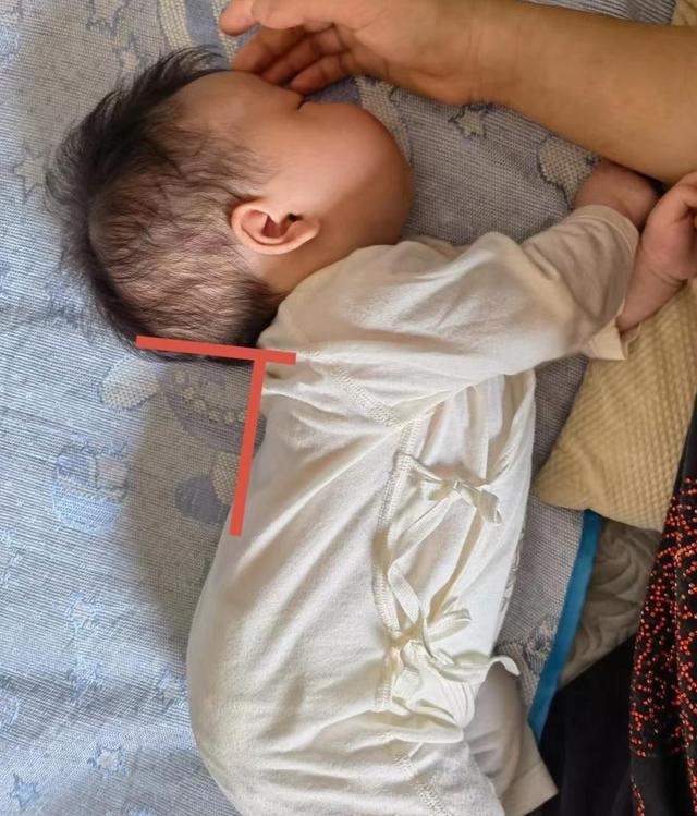 宝妈睡觉痛点,宝妈颈椎引起的头疼怎么办