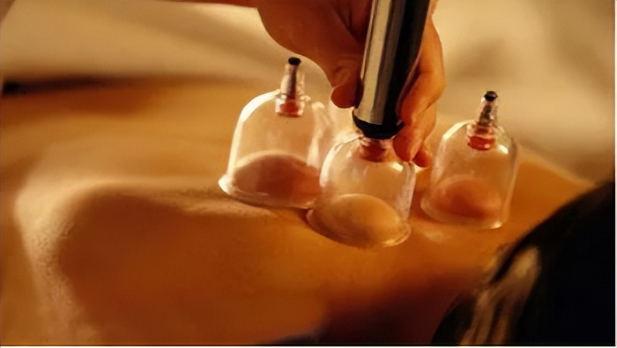 拔火罐益处和弊端,拔火罐有什么好处跟坏处呀